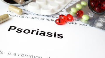 Red Light Therapy for Psoriasis Treatment.
