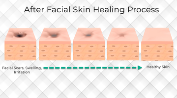 Red light therapy enhances healing after a classic facial.
