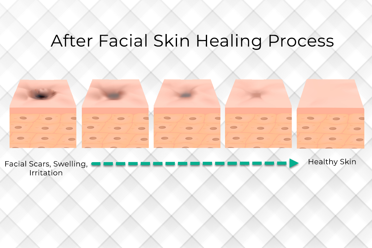 Red light therapy enhances healing after a classic facial. – Recover Red